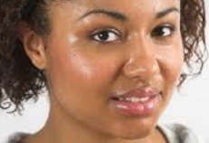 Facial Sweating Kent | Hyperhidrosis Kent | Sweat Excessively Kent