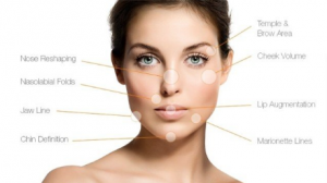 which areas can be treated with Dermal fillers