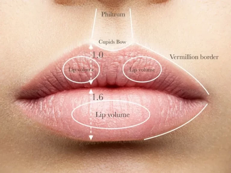 Lip fillers and Russian lips at Persona Medical Aesthetics have become increasingly popular. They are a quick and easy way to add plumpness and volume to your lips. Our skilled medical practitioners can add volume, definition, and fullness to your individual lip shape. In reality most people want their lips to look very natural but a little fuller and/or more defined
