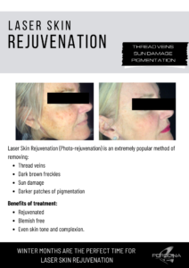 As we age our skin becomes more susceptible to damage due to hereditary conditions, sun and environmental exposure, and the natural ageing process. These factors result in an uneven skin tone, broken veins, and brown patches, dark freckles or sun spots. To target these concerns we use a photo rejuvenation system that combines IPL (intense pulsed light) and radio frequency to allow us to effectively fade and reduce the appearance of these skin imperfections.