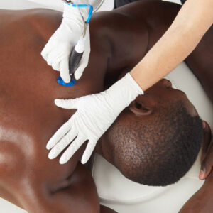 Hydrafacial at Persona Medical Aesthetics Bexleyheath kent