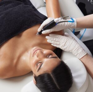 Hydrafacial at Persona Medical Aesthetics Bexleyheath kent