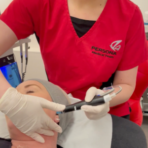 Skin treatments available at Persona Medical Aesthetics Bexleyheath