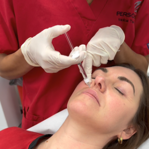 Polynuclotides and trending treatments at Persona Medical Aesthetics Bexleyheath