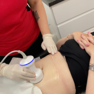 Body treatments include cavitation and radio frequency for body conturing, skin tightening, treatments for body acne and thread veins.