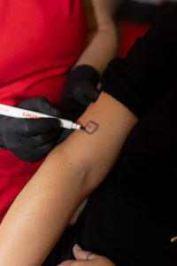 Mole removal and minor surgery, trending treatments Persona Medical Aesthetics Bexleyheath