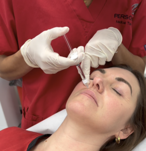 Polynuclotides are an injectable product that contain the DNA from the gametes of either trout or salmon. The DNA is known to help regenerate and improve the skins texture, elasticity, hydration and tone.
