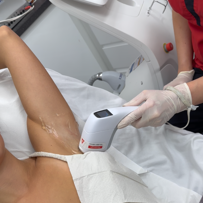 Laser hair removal offers a fast and long-lasting solution for reducing unwanted hair. Whether you’re treating the face, underarms or bikini area, Lumiere delivers comfortable treatments suitable for all skin types.