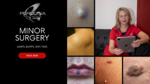 Minor surgery available, skin tags, cyst, lipomas, moles, keratosis removal plus more.