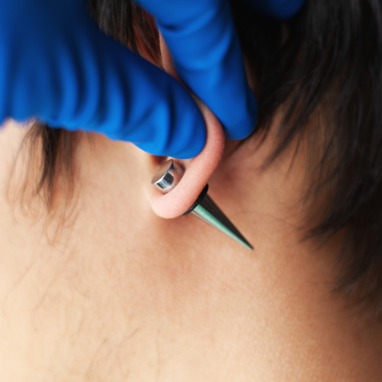 Image with person with a stretcher in their ear