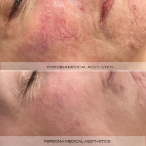 Before and After Instagram Post (1)