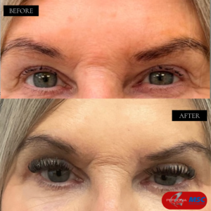 BEFORE & AFTERS PCM & MSC (1)