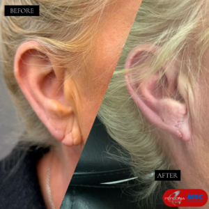 BEFORE & AFTERS PCM & MSC (1)