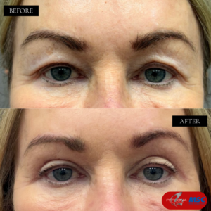 BEFORE & AFTERS PCM & MSC (1) copy 2