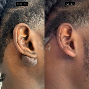 BEFORE & AFTERS PCM & MSC (1) copy