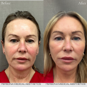 Before and After Instagram Post (3)