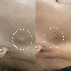 Before and After Instagram Post (3) copy